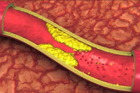 Chuyên Gia Dinh Dưỡng Khuyên Dùng Nồi Chiên Không Dầu Fujihome: Giải Pháp Sống Khỏe Toàn Diện