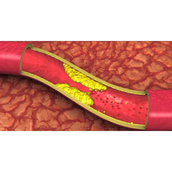 Chuyên Gia Dinh Dưỡng Khuyên Dùng Nồi Chiên Không Dầu Fujihome: Giải Pháp Sống Khỏe Toàn Diện